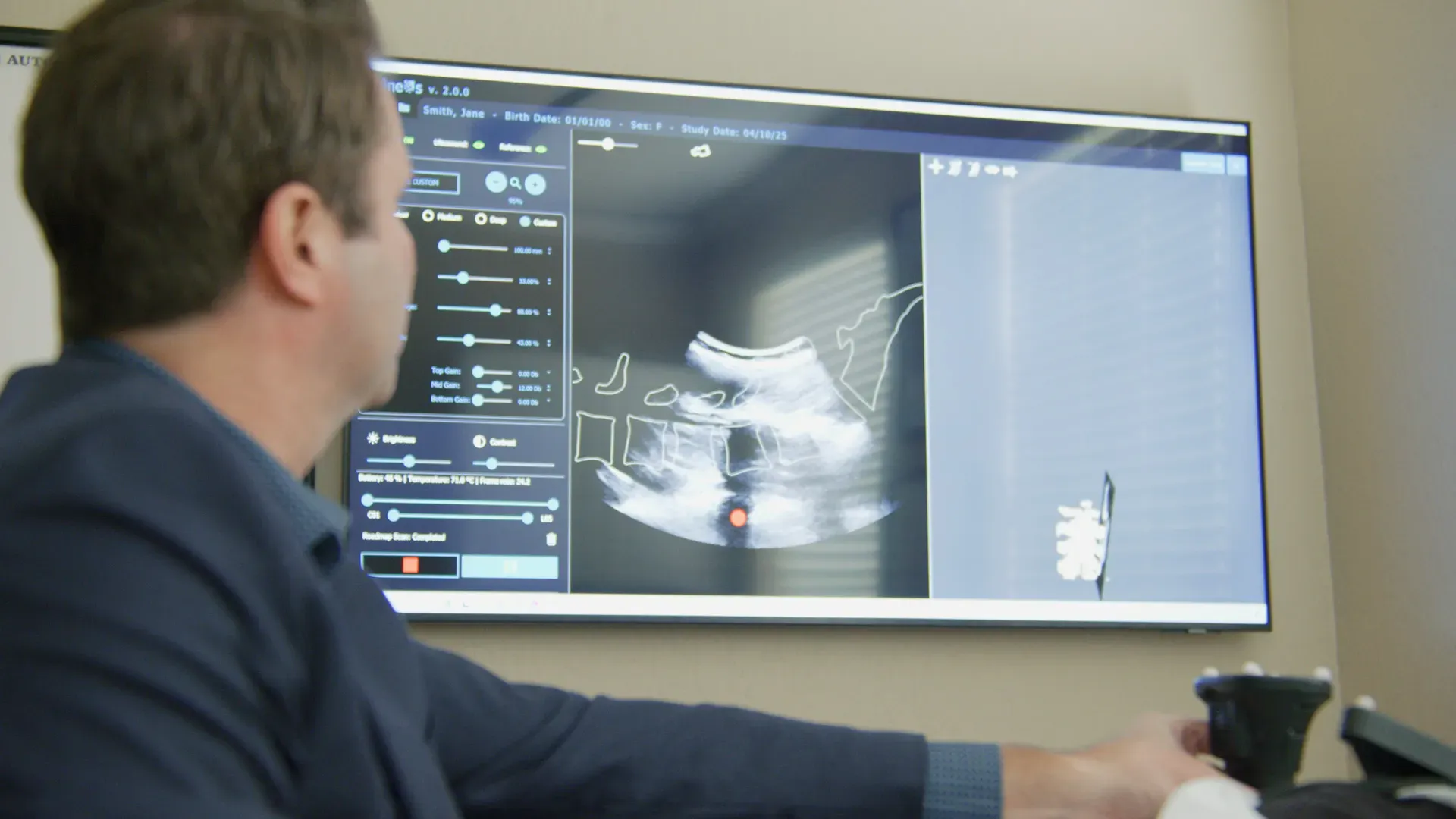 Optitrack Verdure News 04